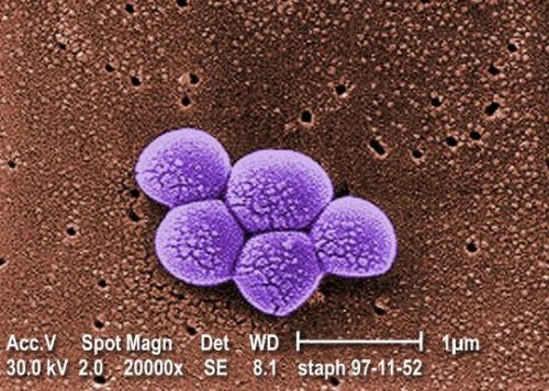 Fig.1.Micrographie colorée obtenue au microscope électronique à balayage de la bactérie Staphylococcus aurea SARM. Grossissement 20000 fois. Crédit CDC. Janice Carr. 